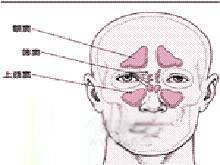 鼻窦气压性创伤的图片