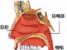 鼻咽肉瘤的图片