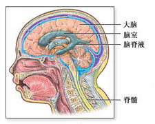 急性播散性脑脊髓炎的图片