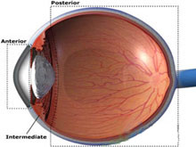 急性虹膜睫状体炎的图片