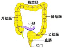 急性结肠假性梗阻综合征的图片