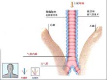 急性气管－支气管炎的图片