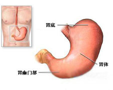 急性胃炎的图片