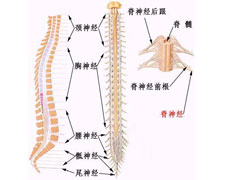 脊髓亚急性联合变性的图片