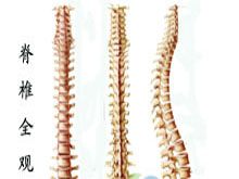 脊椎结核后突畸形的图片