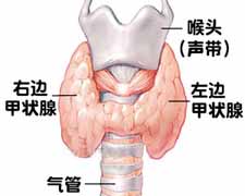 甲状腺舌管囊肿与瘘的图片