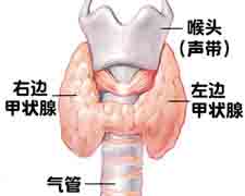 甲状腺腺瘤的图片