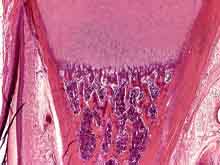 碱性磷酸钙结晶沉积病的图片