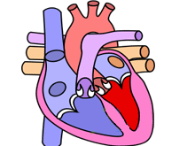 矫正型大动脉错位的图片