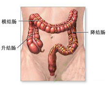 结肠脂肪瘤的图片